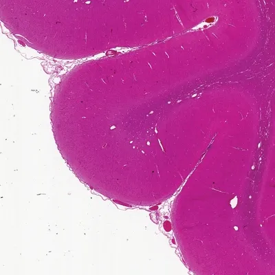 Mammal Cerebrum Pyramidal Neurons, Sec. 7 Μm Silver Stain Microscope Slide