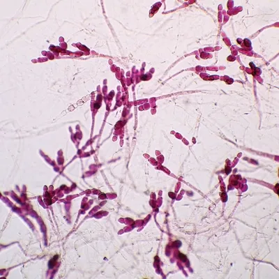 Allomyces Gametophyte, W.m. Microscope Slide